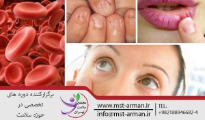 کم خونی | دوره دیالیز | آموزش دیالیز