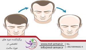 کاشت-مو
