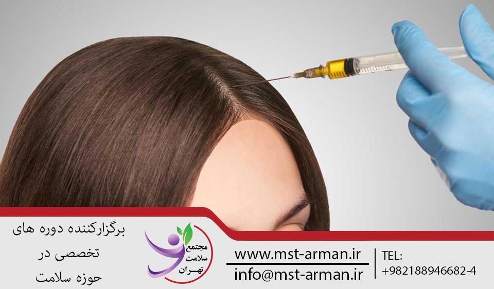 PRP کاشت مو
