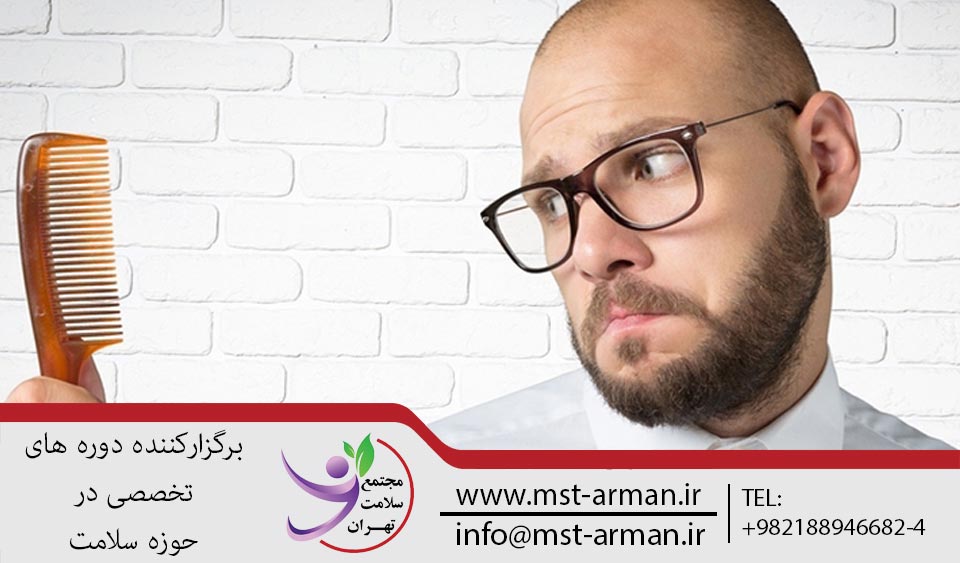 سن ریزش مو