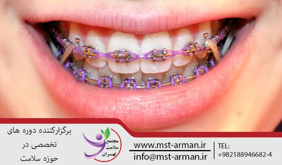 ارتودنسی دندان